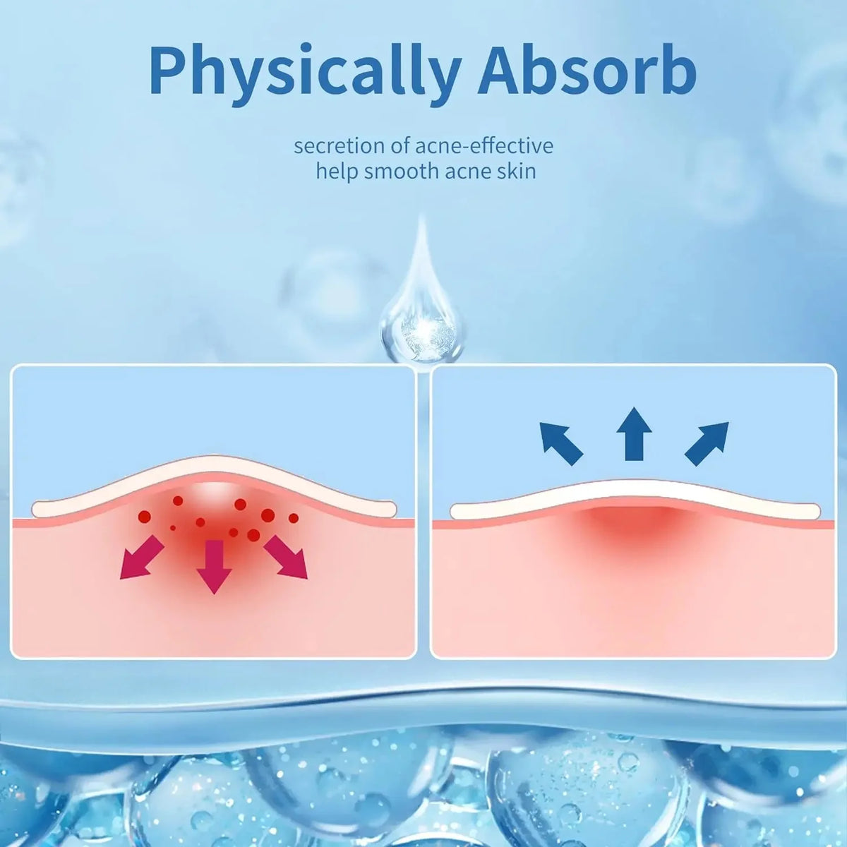 Veltora 180/360pcs invisible acne veneer lump stickers for pore cleansing, oil removal, and skin repair on a facial.