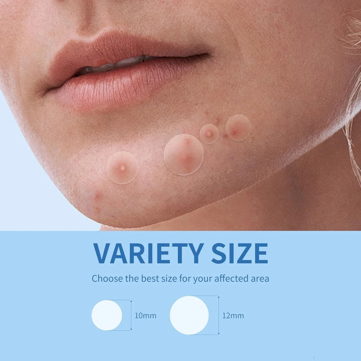 Veltora 180/360pcs invisible acne veneer lump stickers for pore cleansing, oil control, and skin smoothing on facial skin.