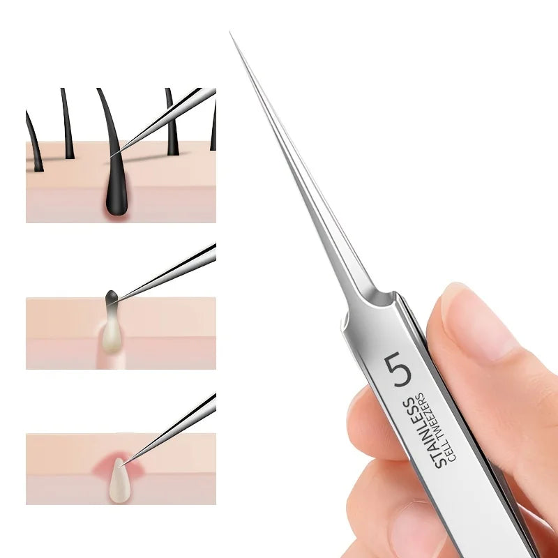 Veltora blackhead removal tweezers made of stainless steel, designed for extracting whiteheads and comedones with precision.