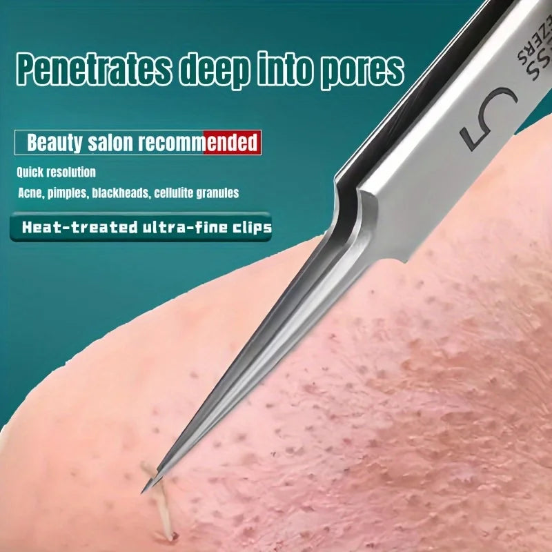 Veltora blackhead removal tweezers made of stainless steel, designed for extracting whiteheads and comedones with precision.