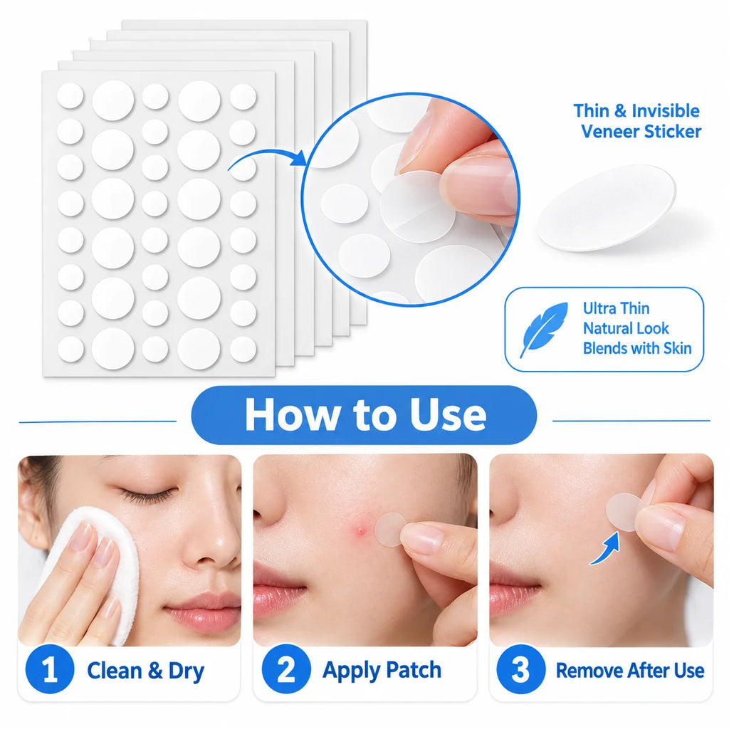 Veltora acne veneer lump stickers for pore cleansing and oil removal, shown on clear skin in a skincare product image.