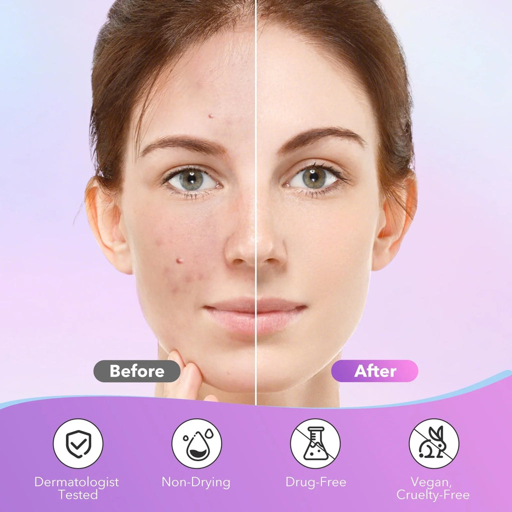 Veltora 1680 Pimple Patches with star-shaped, multi-color concealers for acne and blemish coverage, gentle and non-irritating.